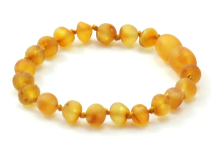 Raw Amber Honey Teething Anklets Bracelets